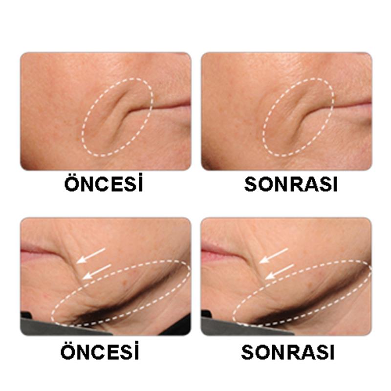 "GOLDEN TOUCH" 24K SERUM | Naturel Medical Pharma